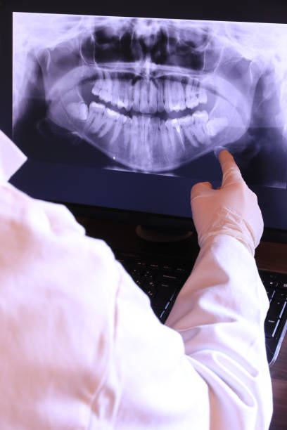 Best Emergency Dental Care for Broken or Chipped Teeth in Northwoods, MO